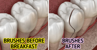 Không nên đánh răng sau khi ăn sáng